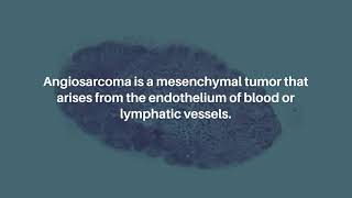 Primary Hepatic Angiosarcoma Treatment Options for a Rare Tumor  Oncoscience [upl. by Yole]