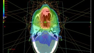 RTU MS Medical Dosimetry [upl. by Jauch616]