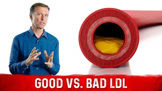 You Have Good and Bad LDL lowdensity lipoprotein [upl. by Ambrosia]