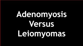 Adenomyosis Versus Leiomyomas on Ultrasound [upl. by Jaella]