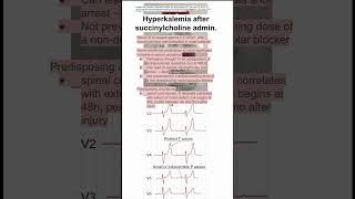 Hyperkalemia after succinylcholine admin [upl. by Ettore]