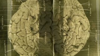 Images of Einsteins brain revealed [upl. by Lehcor400]