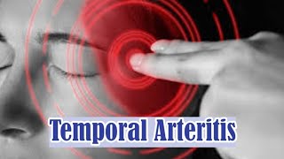 Temporal Arteritis  Giant Cell Arteritis  Symptoms Causes Complications and Treatment [upl. by Tunk565]