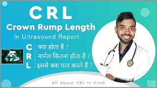 crl means in pregnancy  crl kya hota hai  crl in ultrasound report  crown rump length 6 weeks [upl. by Bryon225]