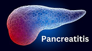 Pancreatitis Everything You Need To Know [upl. by Stoecker529]