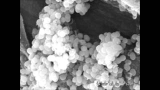 Enterococcus faecalis [upl. by Eigram]