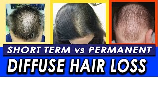 Permanent vs Temporary Diffuse Hair Loss and Telogen Effluvium How to differentiate [upl. by Nerw293]