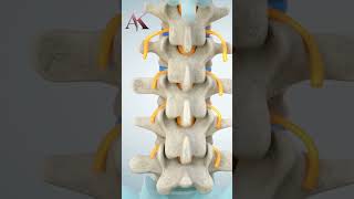 Understanding Intervertebral Discs amp Disc Herniation by Dr Abhijit Kulkarni  Brain amp Spine Surgeon [upl. by Yentnuoc550]