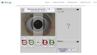 Astigmatismo Miope  Tutorial Retinoscopia [upl. by Warton]