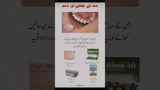 Mouth ulcer treatment [upl. by Ordnas]