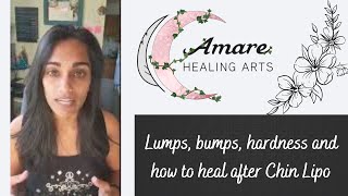 Lumps bumps hardness and how to heal after Chin Lipo [upl. by Elder]