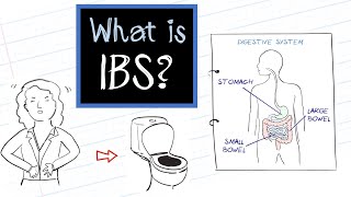 What is IBS Irritable Bowel Syndrome [upl. by Kroo]