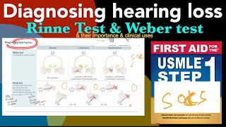 Diagnosing hearing loss  Rinne test amp Weber test amp their clinical uses amp importance in HindiUrdu [upl. by Hanonew300]