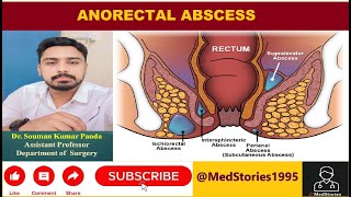 Anorectal Abscess Lecture [upl. by Analed]