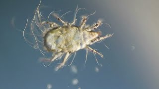 Dust Mite Under the Microscope [upl. by Kellyann]