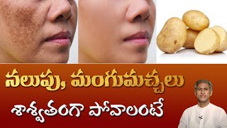 Natural Tip for Dark Spots on Face  Get Rid of Pigmentation  DrManthenas Beauty Tips [upl. by Silecara]