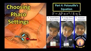 Phaco Fundamentals Part 4 Poiseuilles equation for fluidics in cataract surgery [upl. by Isma]