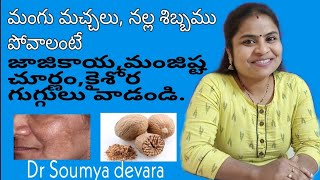 Mangu machalu povalanteNalla shibbamBonguMelasmaHyper pigmentation  Ayurvedam TeluguDr Soumya [upl. by Anilatsyrc]