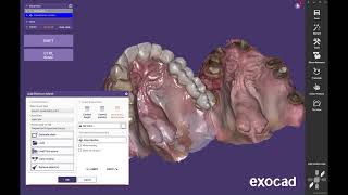 Aligning Multiple scans in Exocad [upl. by Reese]