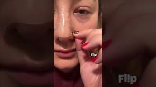 Fazits nose pore patches vs classic pore strips skincare blackheads pimplepatch [upl. by Danette640]