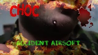 AIRSOFT5 ACCIDENT A EVITERblessuresFAITE ATTENTION A VOUS [upl. by Eelesor]