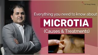 What is Microtia Microtia causes and how to treat it  Designer Bodyz  Dr Parag Telang [upl. by Waverley85]