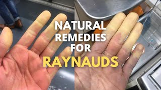 5 natural remedies for RAYNAUDS [upl. by Atirahc905]