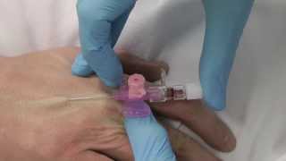 Cannulation How to insert a cannula One Minute Edition Medicine in a Nutshell IV Access [upl. by Lemrahs]