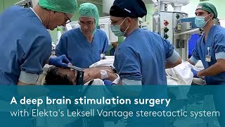 A DBS surgery with Elektas Leksell Vantage stereotactic system [upl. by Thera951]