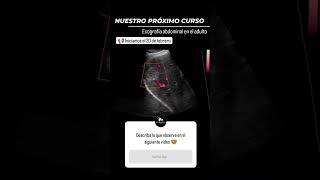 Ecografía abdominal del adulto cursosonline ultrasound [upl. by Novihc]