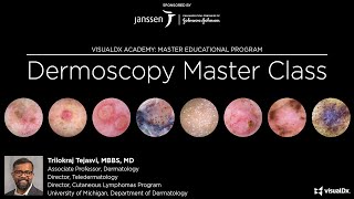 Dermoscopy Master Class [upl. by Najib]