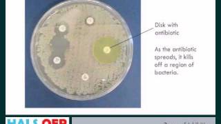 Microbiology resources  How to Measure Zones of Inhibition ZOI [upl. by Litta]