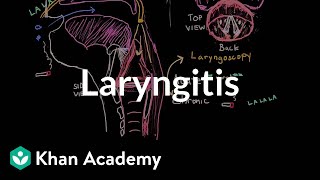 Laryngitis diagnosis treatment and prevention  NCLEXRN  Khan Academy [upl. by Lyrred]