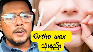 Ortho wax အသုံးပြုနည်း [upl. by Inalaek391]