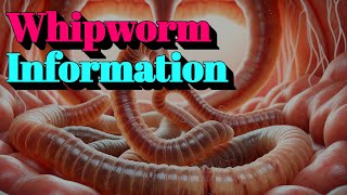 Whipworm Information 🔬Tier4 Infectious Disease [upl. by Cilegna]