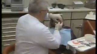 Complete Denture Overview [upl. by Godrich]