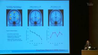 11th Annual Yale NEABPD Conference Mentalization in Borderline Personality Disorder [upl. by Notyal789]