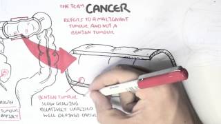 Cancer  Introduction I [upl. by Nnylyrehc]