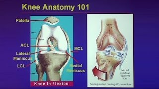 Common Traumatic Knee Injuries Oh My Aching Knee [upl. by Oidualc851]