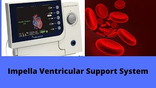 Impella Ventricular Support System [upl. by Darby681]