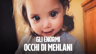 I grandi occhi di Mehlani la bambina che combatte una rara malattia genetica [upl. by Shiverick]