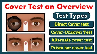 Cover test part2  uncover test Alternate cover test  Prism bar cover test [upl. by Ahsatsan887]