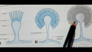 Aspergillosis  Laboratory Diagnosis  Fungal Infection MICROBIOLOGY MBBS [upl. by Intosh]