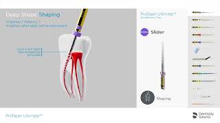 ProTaper Ultimate Endo File System  Shaping Sequence [upl. by Retxab]