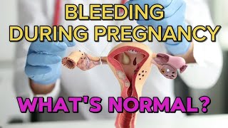 BLEEDING DURING PREGNANCY  WHATS NORMAL [upl. by Slaughter]