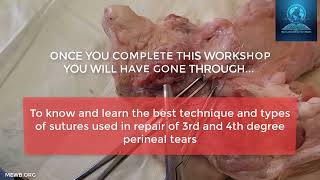 Perineal Tear Repair Workshop Promo Video [upl. by Leyes]