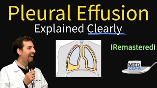 Pleural Effusions  Causes Diagnosis Symptoms Treatment [upl. by Amador949]