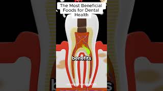 Vitamins and Minerals for Healthy Teeth and Gums short [upl. by Yriek373]