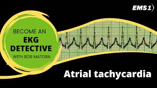 Atrial tachycardia  EKG Detective [upl. by Nonac]