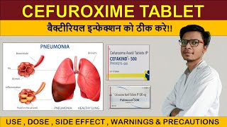 cefuroxime axetil 500 mg tablet uses in hindi  cefakind 500  pulmocef 500 [upl. by Nnairb865]